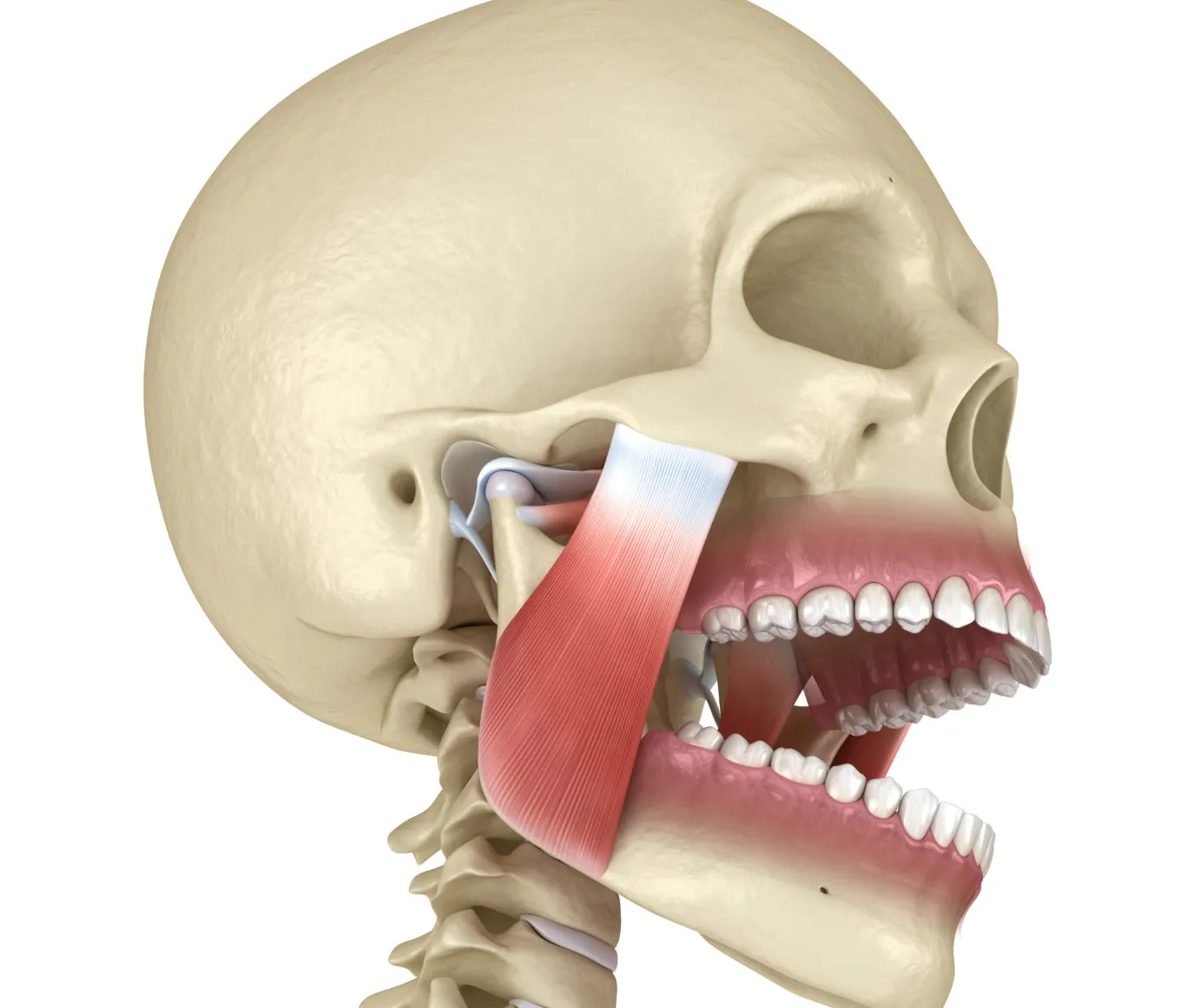 ¿Qué es la disfunción temporomandibular?