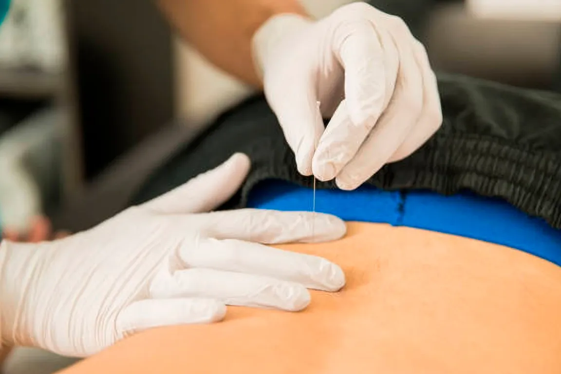 ¿Qué es la punción seca y cómo ayuda al dolor mandibular?