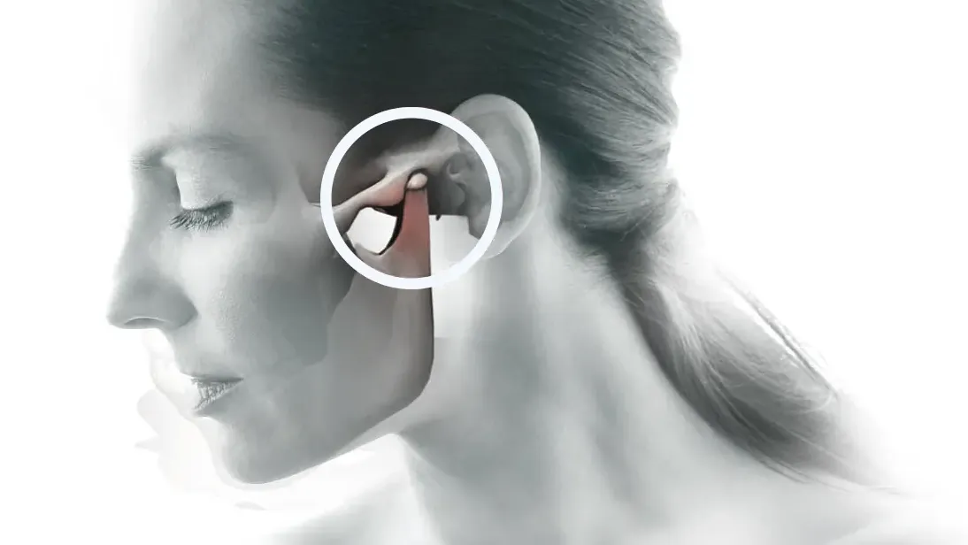Entendiendo el dolor en la articulación temporomandibular (ATM)