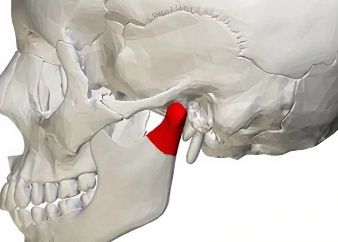 Estrategias de tratamiento para el tinnitus causado por disfunción de ATM